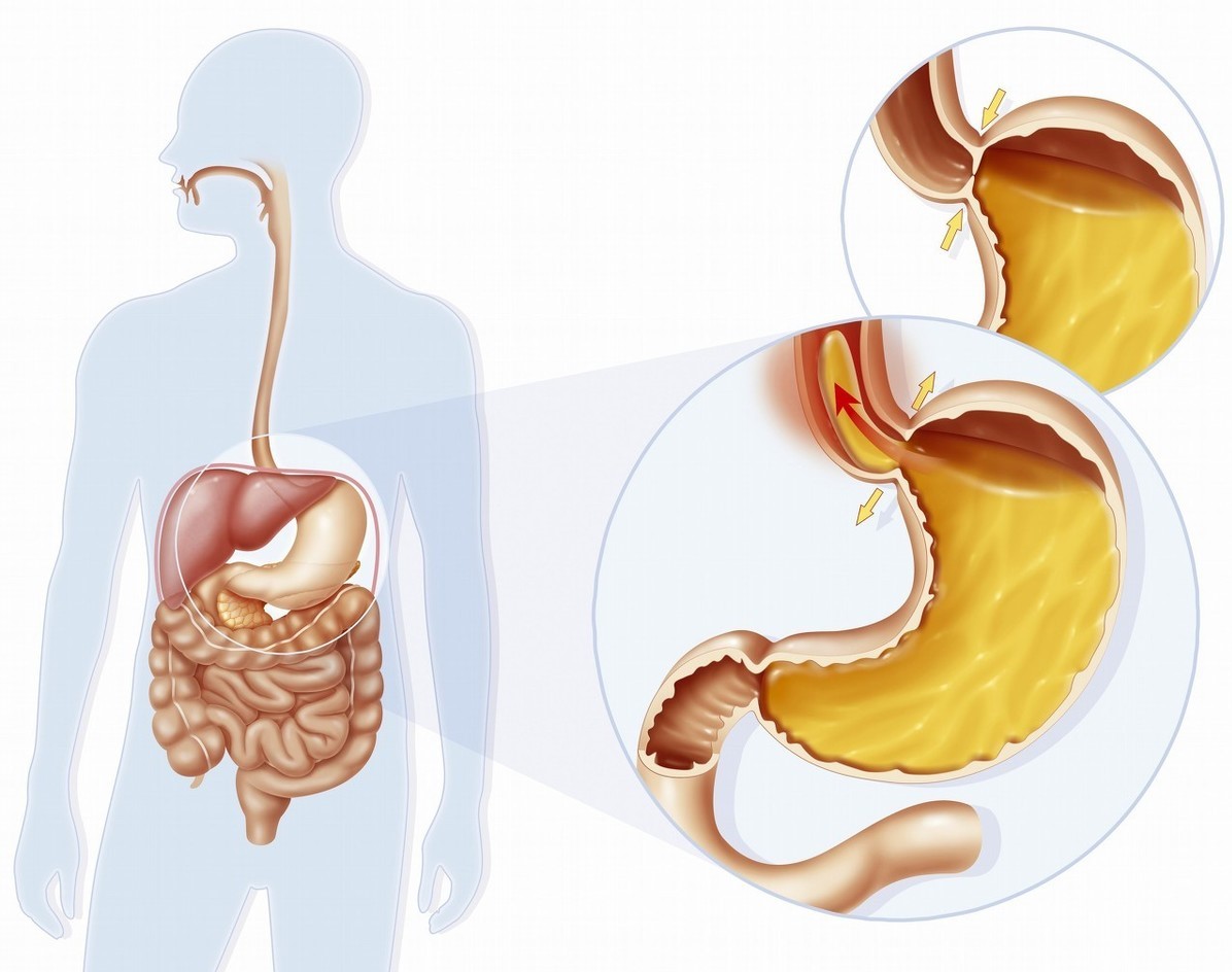 长期咳嗽不好是什么原因引起的,长期咳嗽老不好怎么治