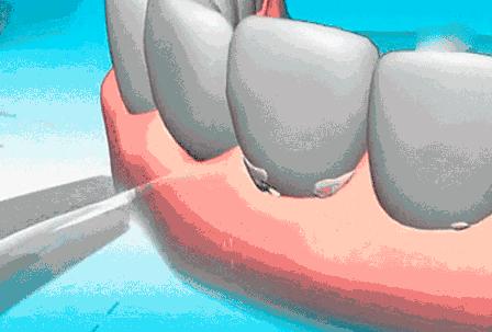 口腔行业进入真正的洗牌期,口腔行业大洗牌