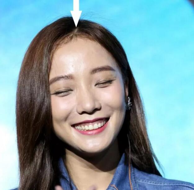 头发细软贴头皮怎么改善,头发细软贴头皮