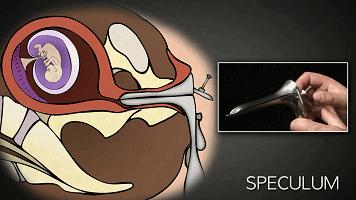 堕胎到底有没有恶果,堕胎真的那么可怕吗