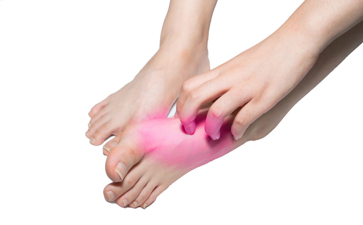 有脚气的人，要知道得脚气的这3个原因，从根源扼制