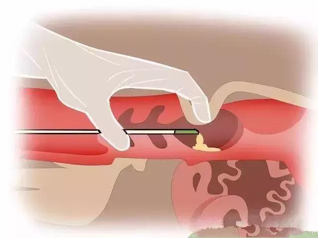 给牛人工授精注意哪些,给牛人工授精教学