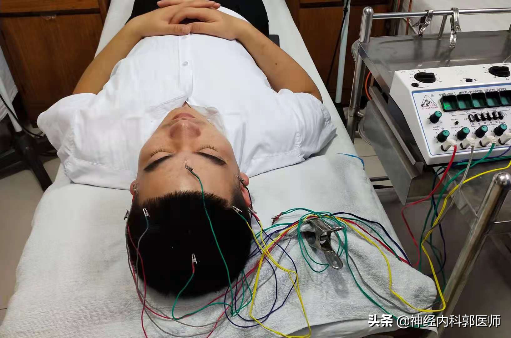 神经性头痛针灸扎什么部位,针灸对神经性头痛有效吗