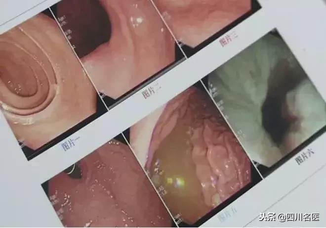 鍚冩牀瀛愯儍鍑鸿,鍚冩牀瀛愬鏄撹鍣庡埌