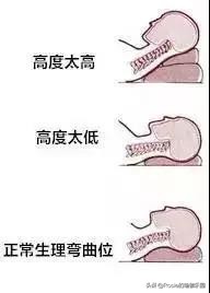 富贵包快速消除背部方法,为什么背有富贵包