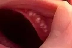 新妈妈别再乱担心了,月嫂总结宝宝的这28种情况是正常的