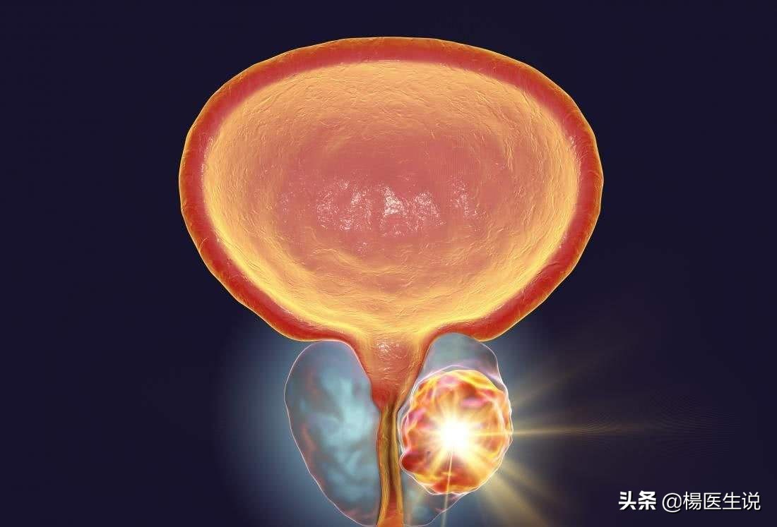 前列腺癌肿瘤标志物,肺癌肿瘤标志物只做cea