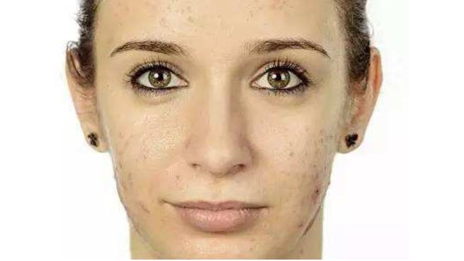 顽固便秘肠胃不蠕动,注意日常生活习惯便秘不再是难题