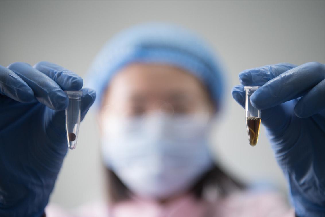 胚胎移植后注意事项细说,胚胎移植后有哪些需要注意的