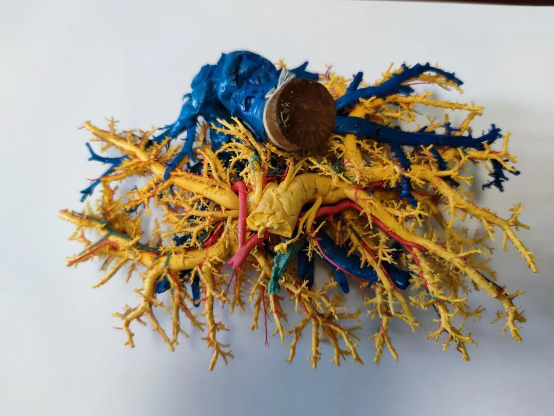 把肝脏取出来,把肝取出来会怎么样