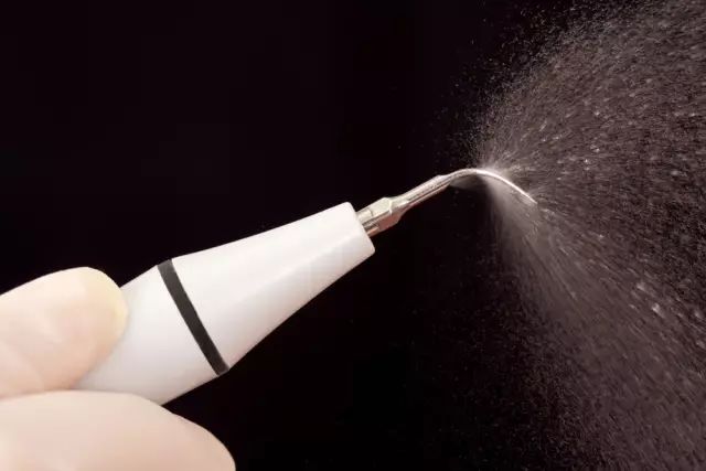 小孩可以洗牙视频,儿童可以洗牙吗洗牙的过程是什么