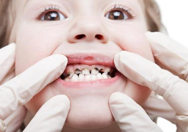 怎么让宝宝戒掉奶瓶,宝宝不会喝奶瓶怎样戒奶