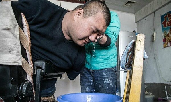 男子没有四肢,男子天生无四肢