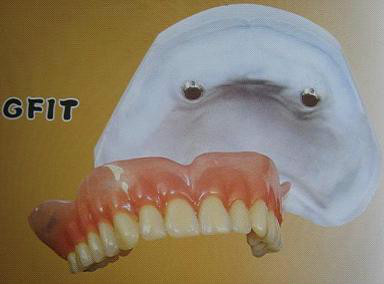 各种假牙价格一览表,假牙十大品牌价格表