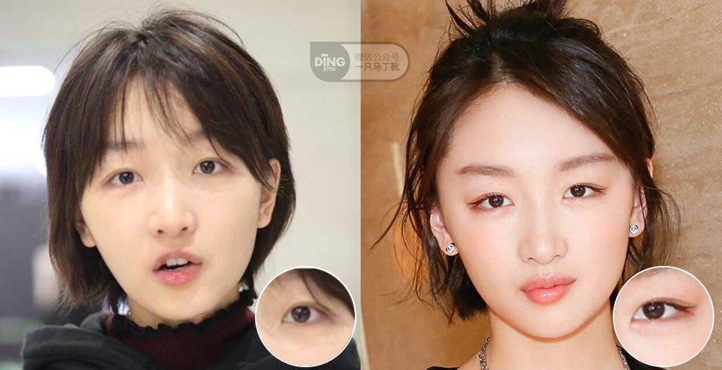 为什么眼神呆滞无神怎么训练,表情僵硬眼睛无神