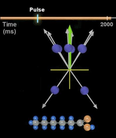 磁共振怎么看大脑基底节区和丘脑,脑核磁能不能看清楚骨头
