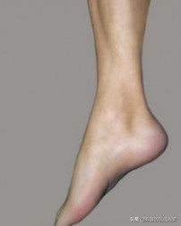 跷二郎腿腓总神经损伤吃什么药,跷二郎腿腓总神经损伤怎么治疗