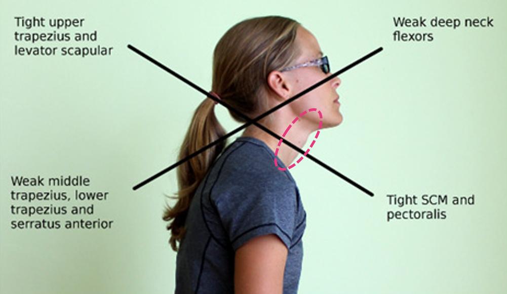 有效改善体态,提升气质减肥瘦全身方法