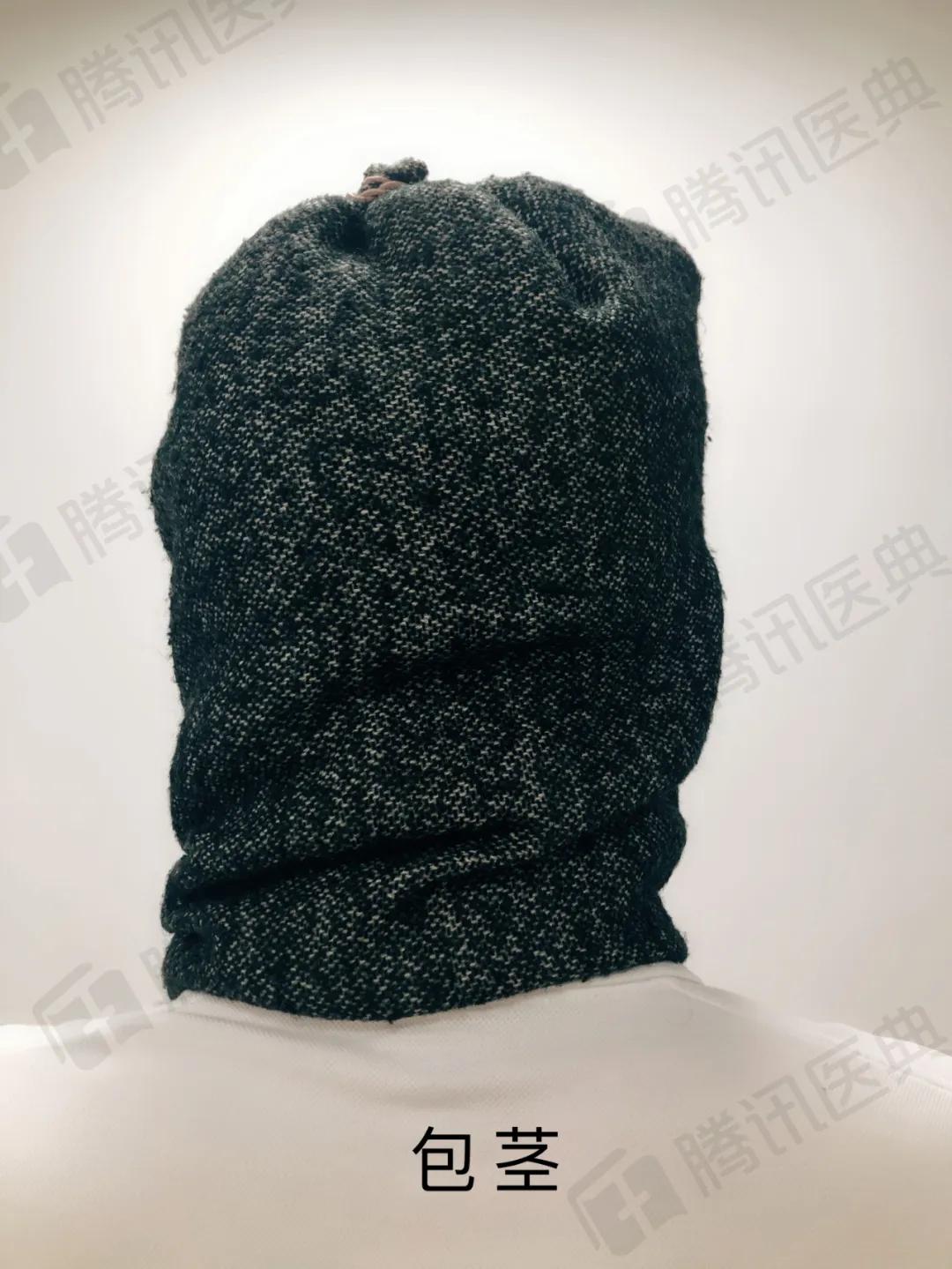 割包皮有可能割短吗,割包皮能治疗好疱疹吗