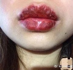 内行人为什么不建议漂唇,作为一名医生一直被人质疑