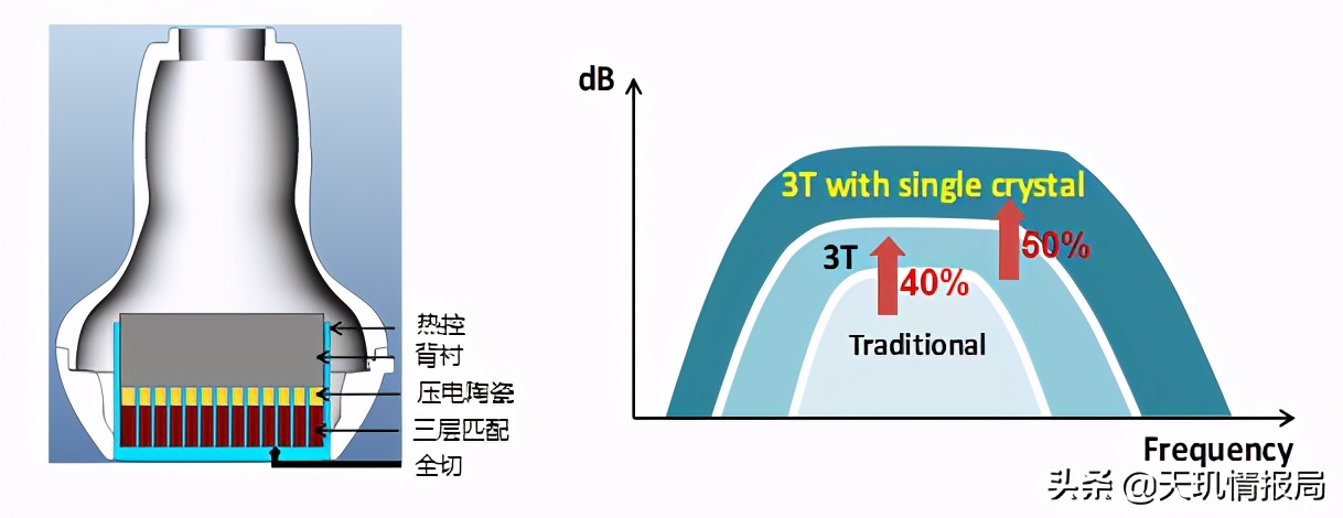 迈瑞医疗和新产业哪个更有前景,迈瑞医疗和开立医疗