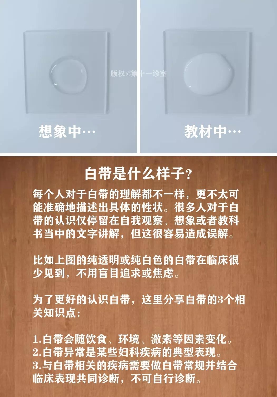 女人妇科白带的知识,女生白带冷知识