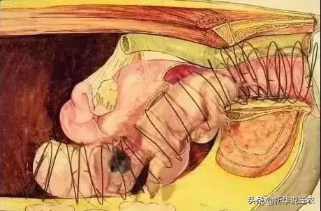 接产要领及接产步骤,助产催产方法