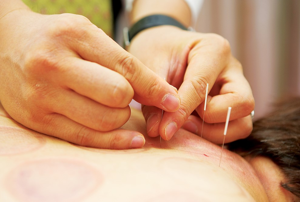 钟利群主任谈:中医治疗梅尼埃病效果明显