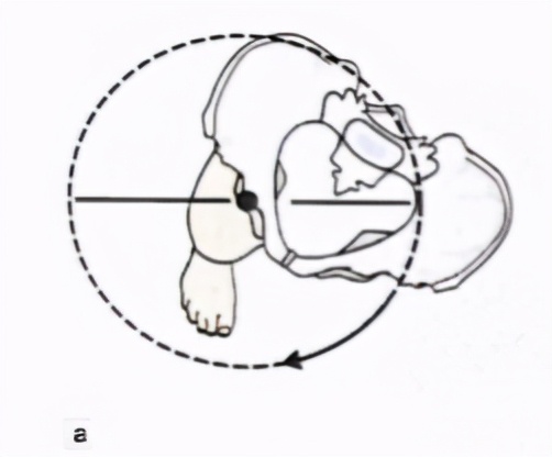 走着走着低头一看,裤子裙子跑偏了?来认领一下是否骨盆旋转