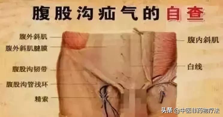 每天揉肝经10分钟,揉按大腿内侧能疏肝理气