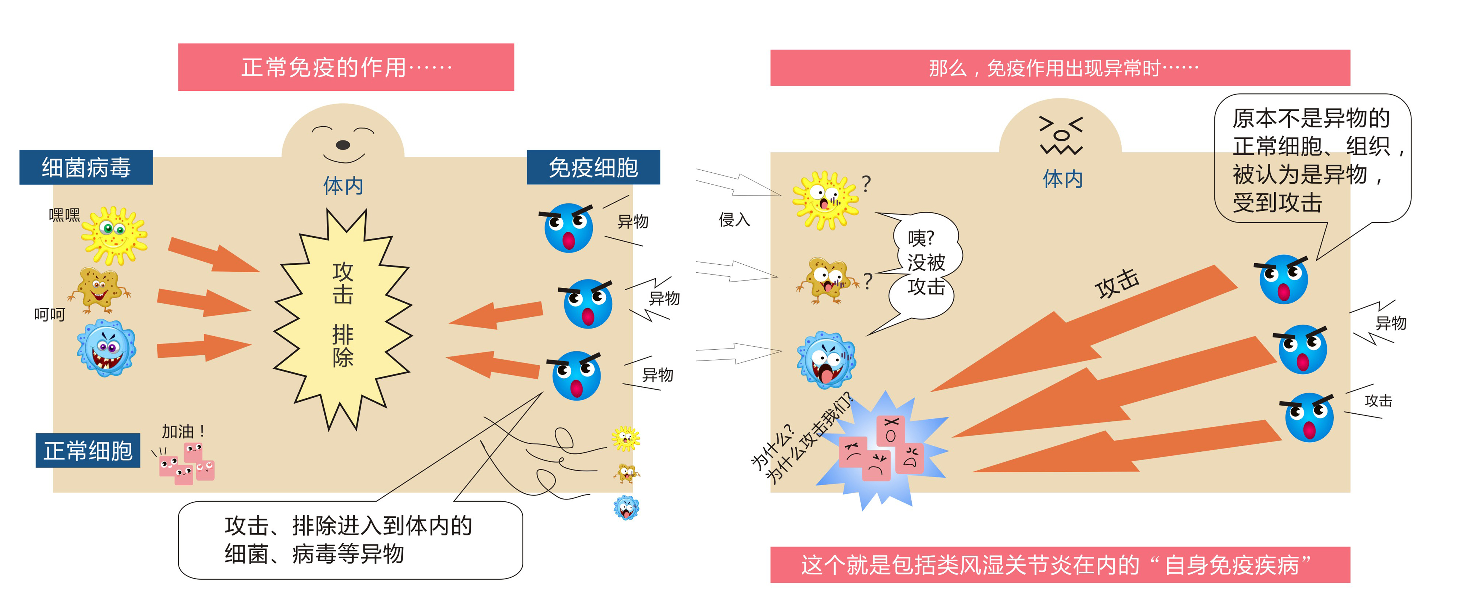 类风湿关节炎的炎症及关节破坏是如何发生发展的？如何正确消炎？