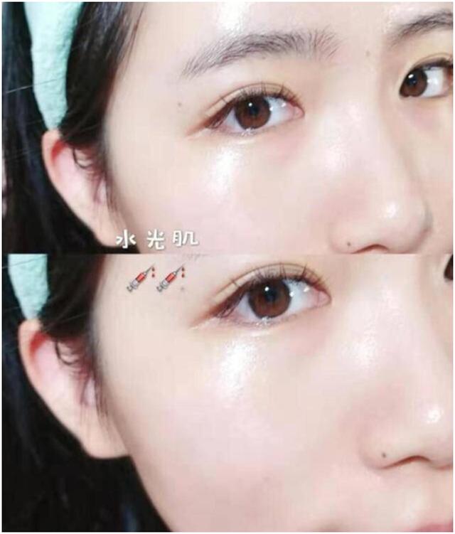 干得起皮泛红怎么办,皮肤干燥拯救大干皮