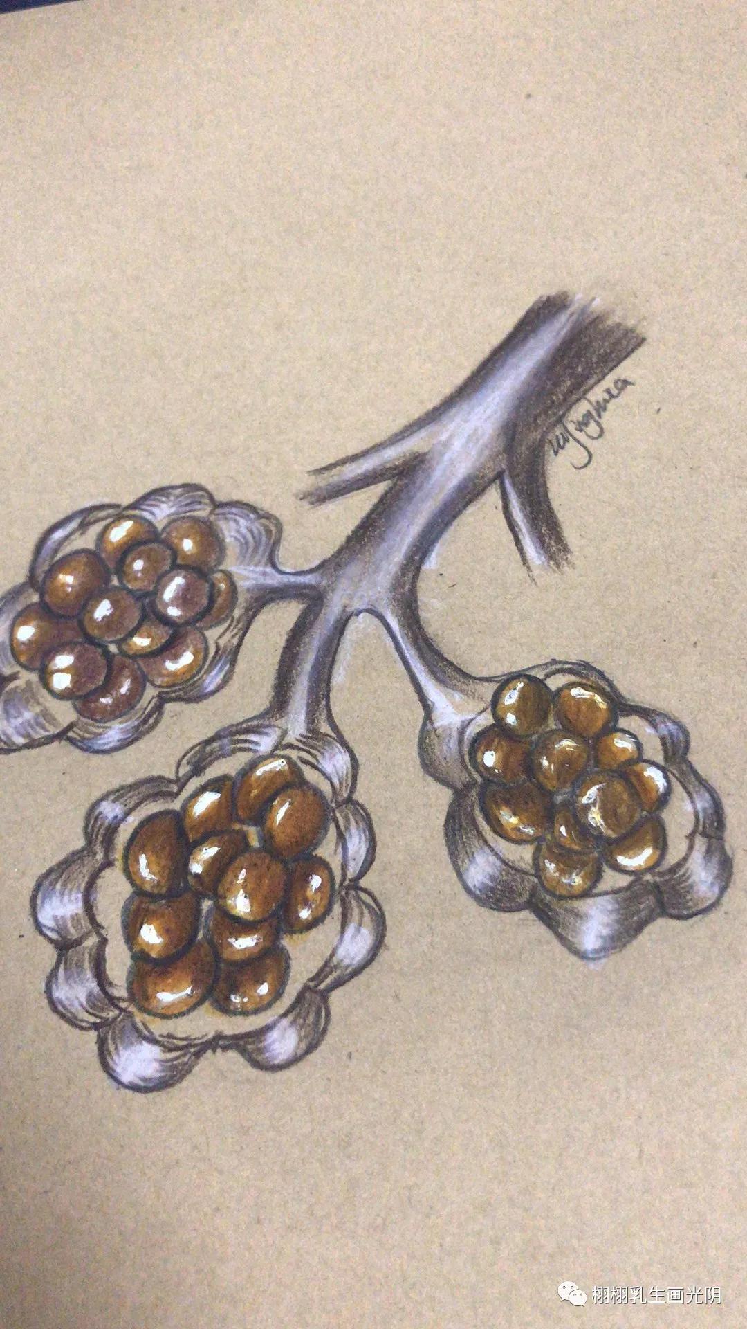 乳腺囊肿是什么意思严重吗,乳腺囊肿的由来