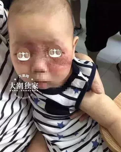 夏天最要小心这四种虫子,在外面遇到这种虫子千万别用手拍