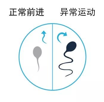 小蝌蚪治疗不孕不育,如何调理不孕不育的小蝌蚪