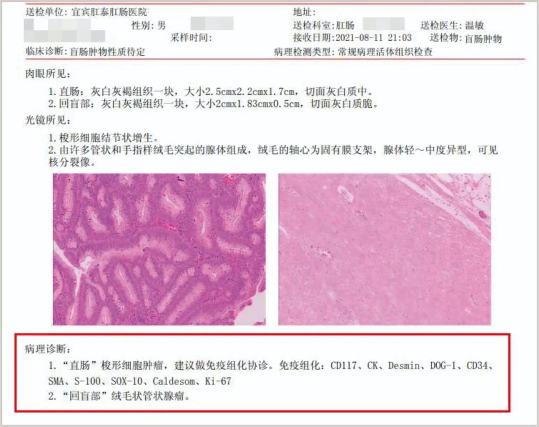 42岁男子行肠镜检查，竟查出二种瘤