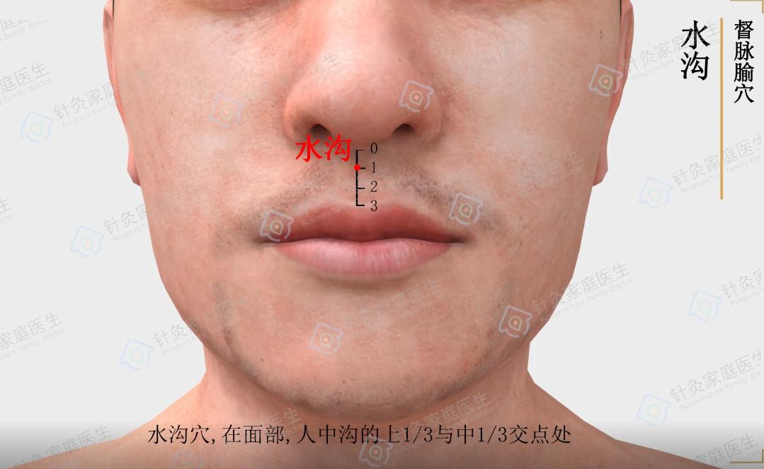 中医针灸常用的急救法，你知道吗？