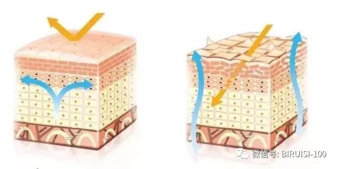 *褐斑黄**,你真正了解多少?碧芮斯带你真正了解“它”