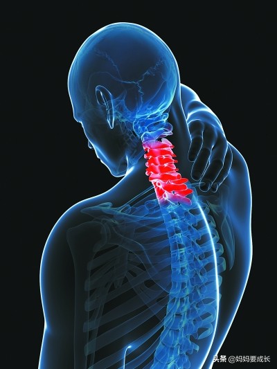 颈椎病为什么越锻炼越重,颈椎病手麻会不会越来越厉害