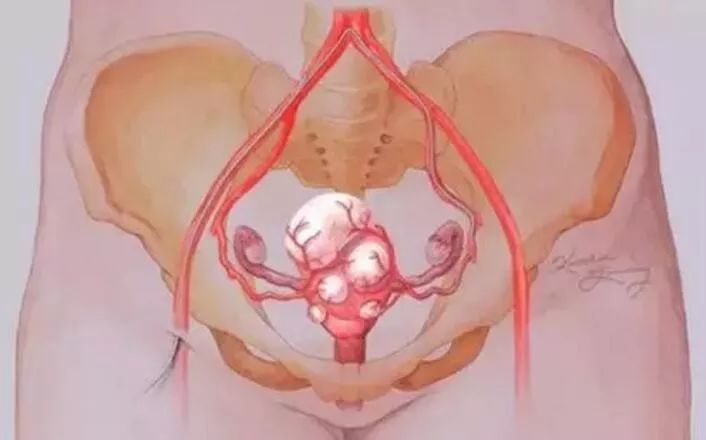 没做过人流，为何也成为输卵管堵塞的受害者？