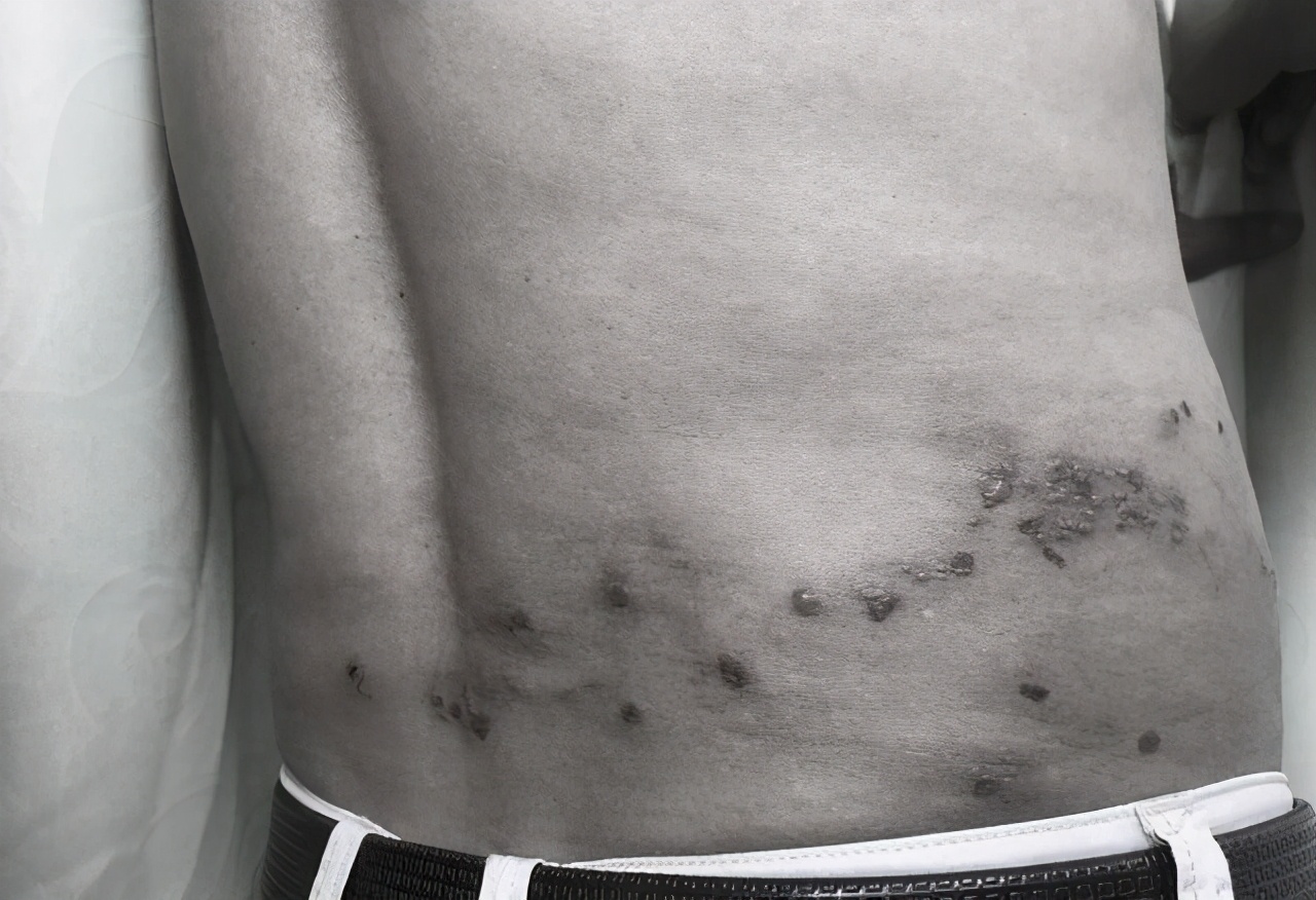 大妈被蛇咬到手里捏着蛇,大妈被蛇缠腰画画