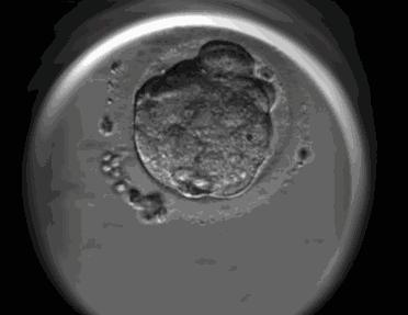 生物实验使用显微镜怎么用双眼看,生物显微镜人眼看到的图像