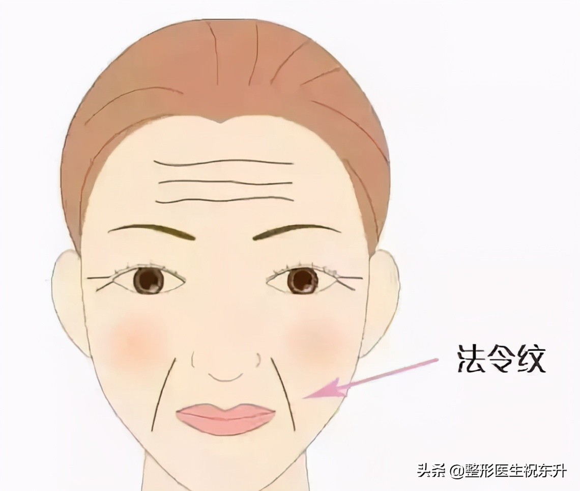 终于知道法令纹怎么来的了,关于法令纹的误解