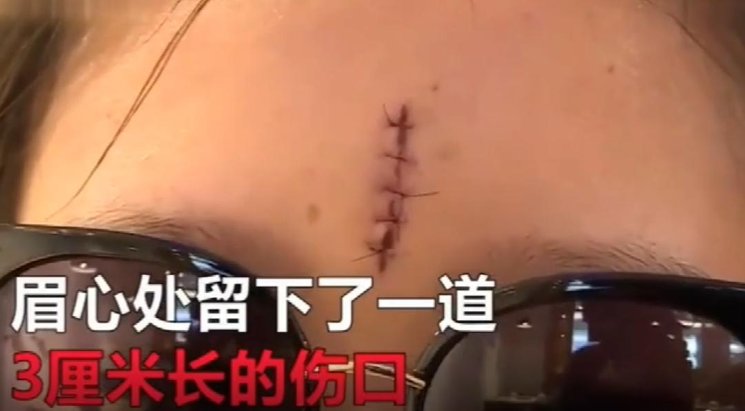 少女餐厅内用餐滑倒受伤,糟糕少女