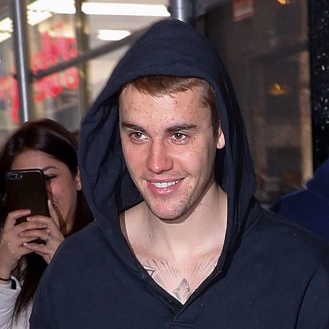 贾斯汀比伯有什么病吗,贾斯汀比伯吸毒后遗症