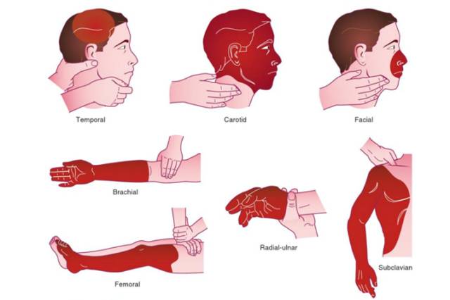 止血可用卫生巾吗,卫生巾的注意事项