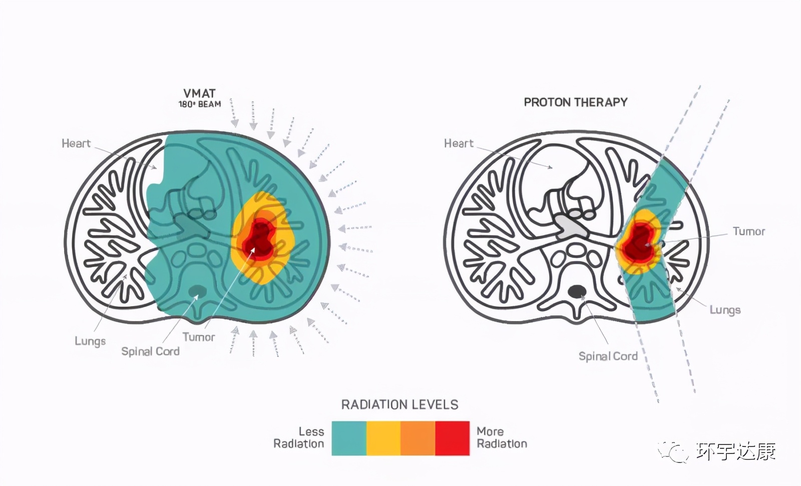 讲座+在线咨询|肿瘤专家全面揭秘:肺癌质子治疗的优势与适应症