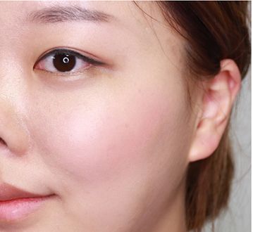 脸上有螨虫很痒怎么治,感觉脸上螨虫在动