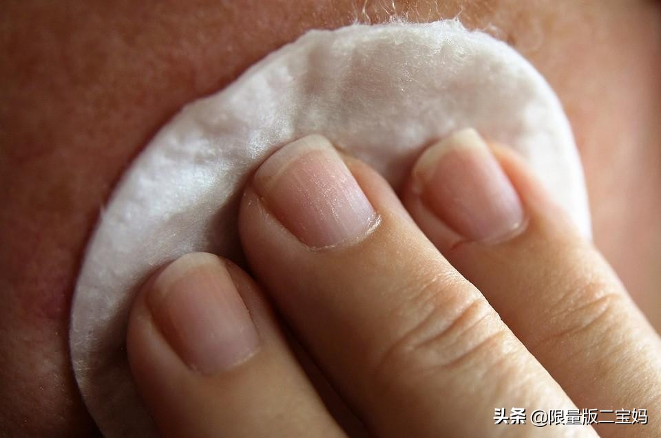 皮屑头屑,干皮冬季头屑多怎么办