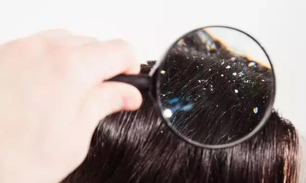 螨虫辟谣大全,你知道螨虫的危害吗涨知识